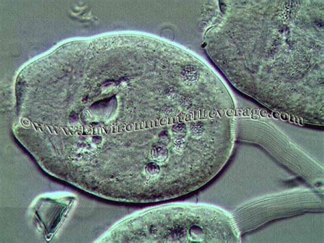  Burger Ciliate: Can You Handle This Microscopic Carnivore's Eating Habits?