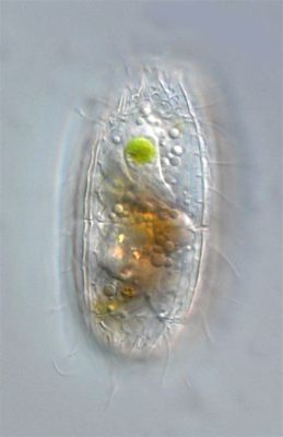 Coleps! A Tiny Ciliate Masterfully Navigating Its Aquatic World With Remarkable Precision