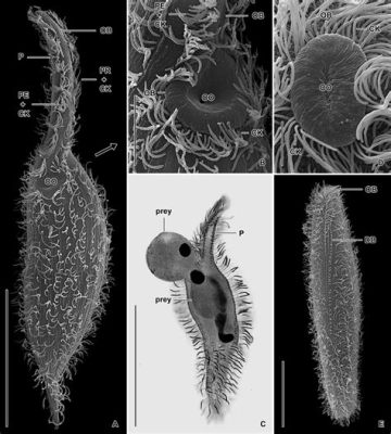  Litonotus!  A Ciliate That Swims Like It’s Wearing Tiny Flippers and Eats Algae Like It’s Going Out of Style