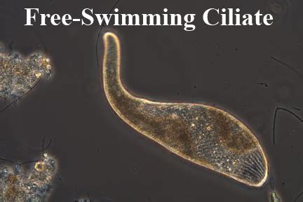 Loxodes! This Free-Swimming Ciliate Masters a Whimsical Dance Through Water