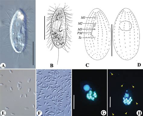 Understanding the Ubiquitous Uronema: Exploring its Lifestyle and Ecological Impact as a Tiny Predator!